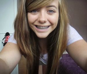 sexy girl with braces